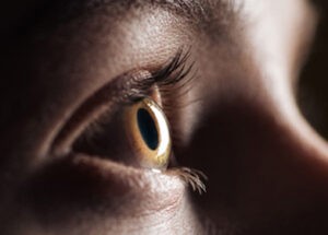 Glaucoma: What You Need to Know to Protect Your Vision