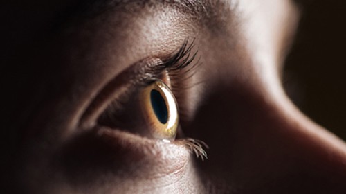Glaucoma: What You Need to Know to Protect Your Vision