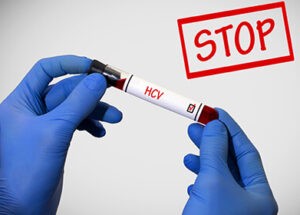 The Answers To All Your Questions Related To Hepatitis C