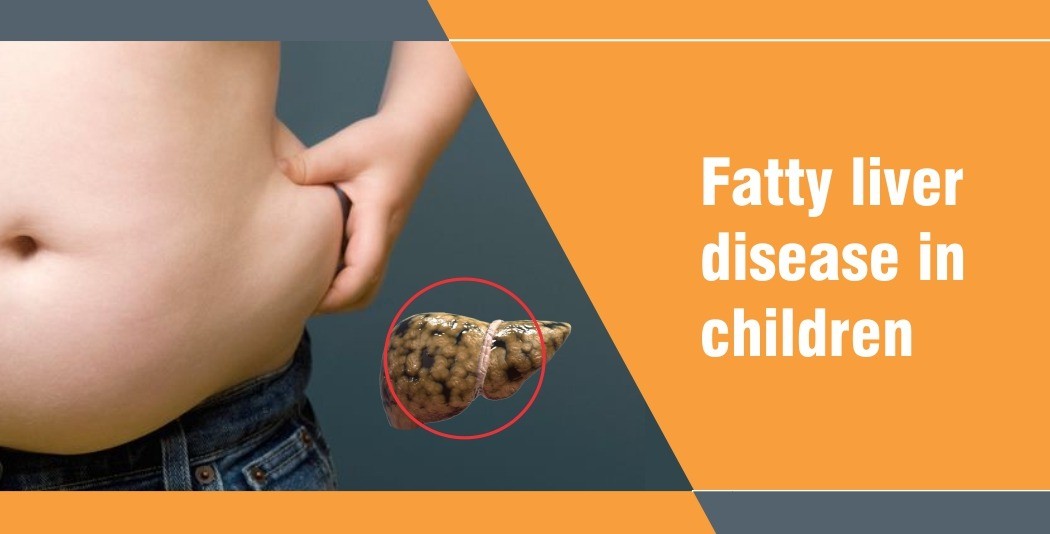 Fatty liver disease in children