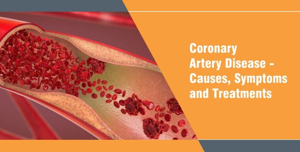 Coronary Artery Disease – Causes, Symptoms and Treatments