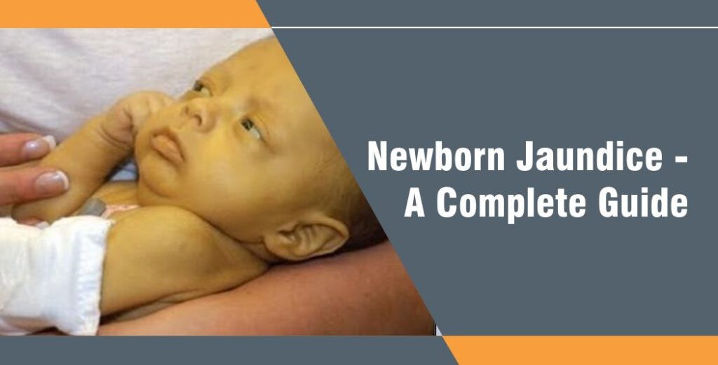 Newborn Jaundice – A complete guide