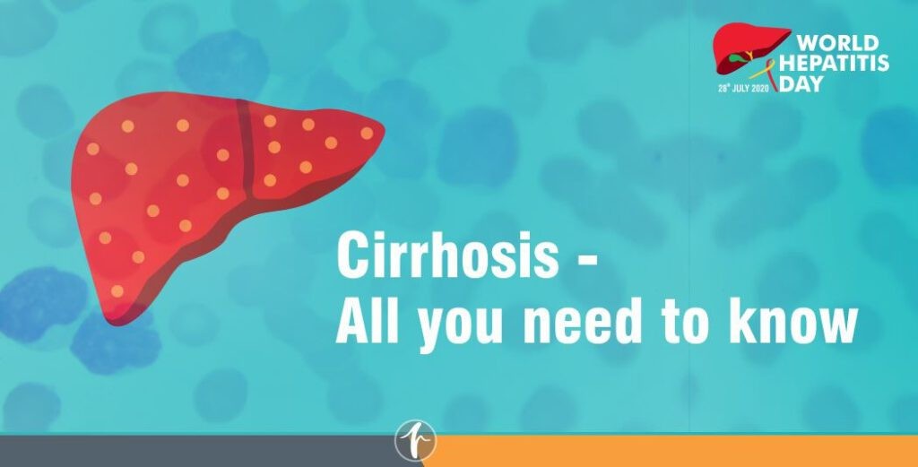 Cirrhosis – All you need to know