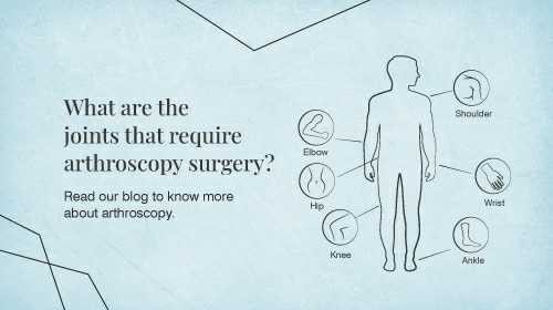 What is Arthroscopy Surgery