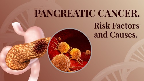 Pancreatic Cancer: Symptoms, Causes and Treatment