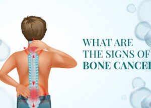 Bone Cancer: Types, Causes & Symptoms