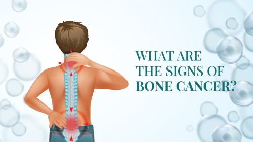 Understanding the Signs and Symptoms of Bone Cancer