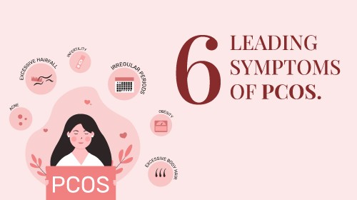 Polycystic ovarian syndrome (PCOS) – Symptoms and causes
