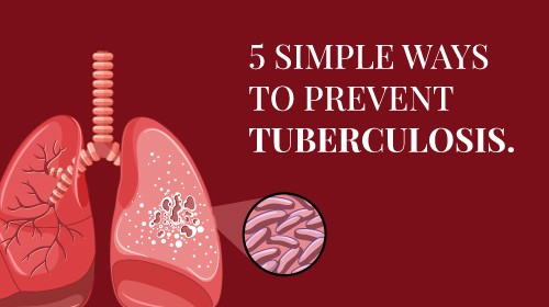 Tuberculosis (TB): Symptoms, Types, Diagnosis, and More