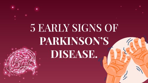Parkinson’s Disease:  What is Parkinson’s Disease