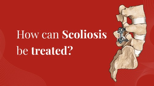 How can Scoliosis be treated?