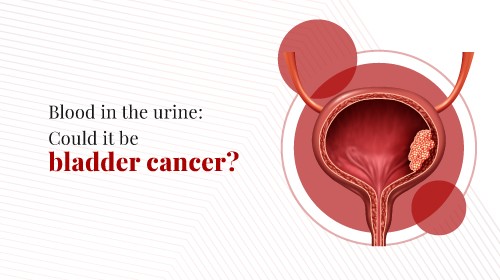 What Is Bladder Cancer?