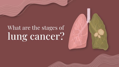 Is lung cancer curable?