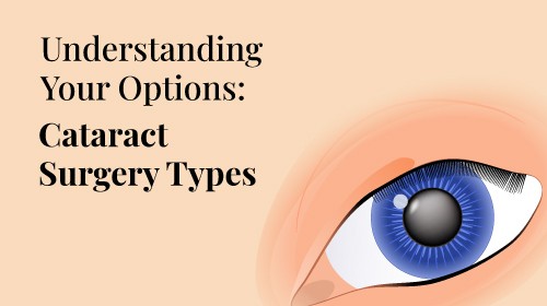Cataract Surgery: Types, Options, and Procedure