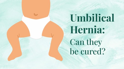 Umbilical hernia in babies-what is it? Does it need any treatment