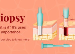 What is a biopsy