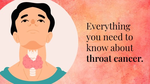 Throat cancer: Symptoms, causes, and treatment