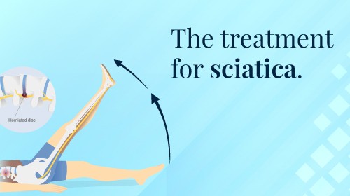 How to Cure Sciatica Permanently
