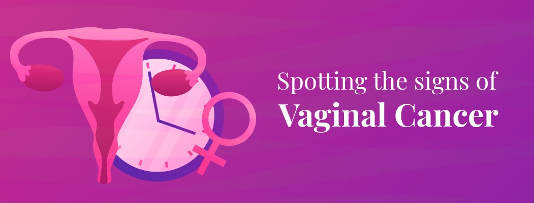 Vaginal Cancer: Symptoms and Causes