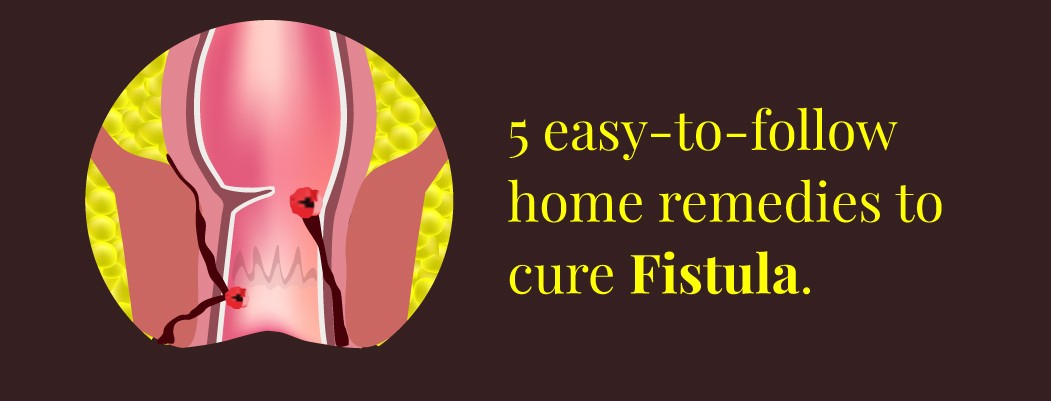 How to cure fistula permanently at home