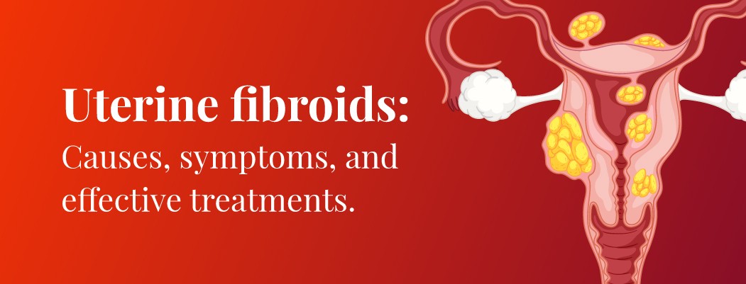 What are Uterine Fibroids?  Causes, Symptoms and Treatment