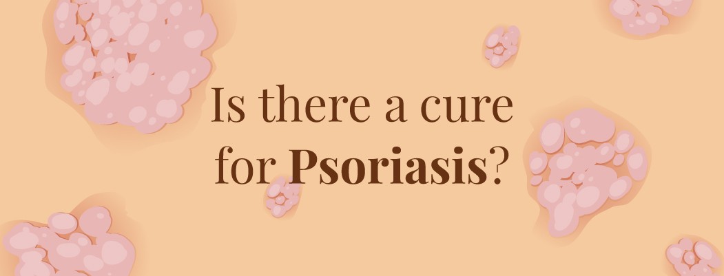 Is there a cure for Psoriasis?