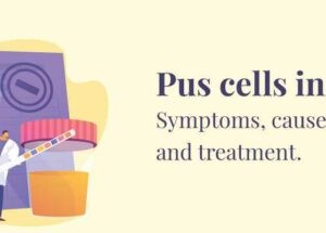 What is pus cells in urine
