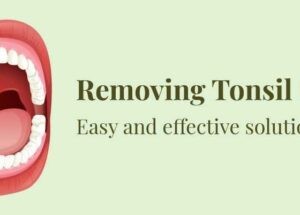 How to remove tonsil stones