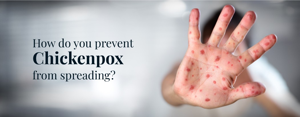 How Does Chickenpox Spread?