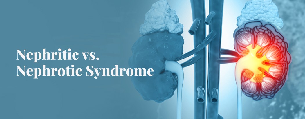 What is the Difference Between Nephrotic and Nephritic Syndrome?