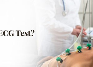 What is an ECG Test?