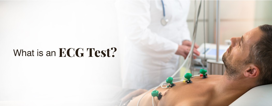What is an ECG Test?