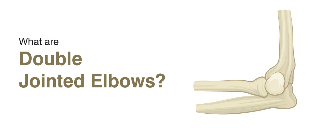 Double jointed elbows: Causes, Symptoms, and Prevention