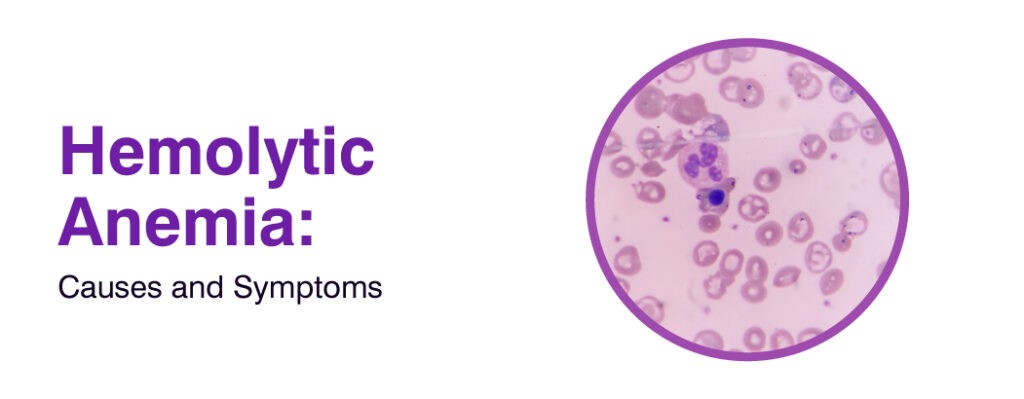 Hemolytic Anemia : Causes and Symptoms