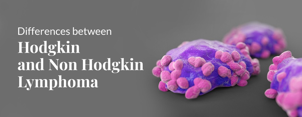 Difference between Hodgkin and non Hodgkin lymphoma