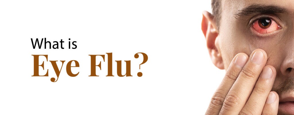 What is Eye Flu?