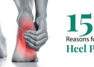 15 Reasons of Heel Pain