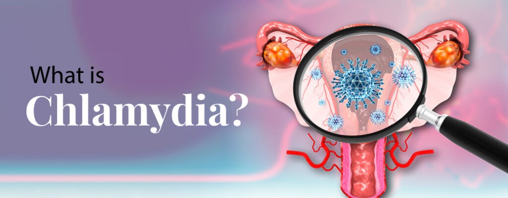 What is Chlamydia?