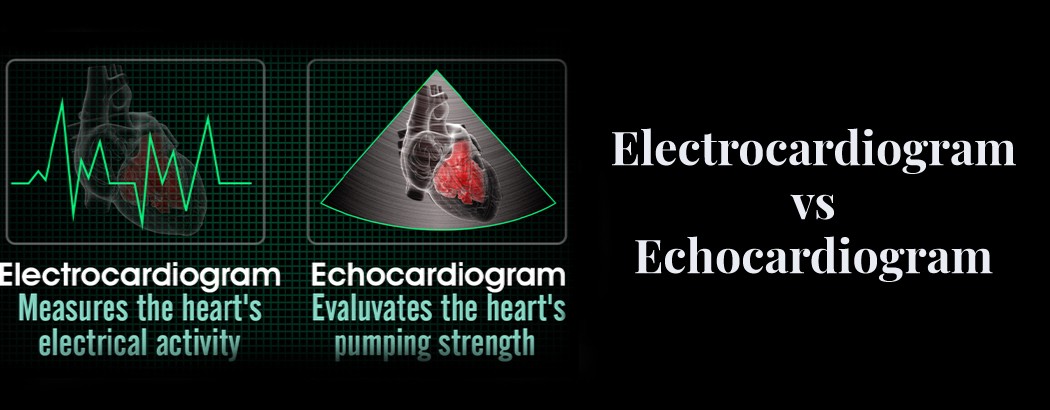 Electrocardiogram vs. Echocardiogram