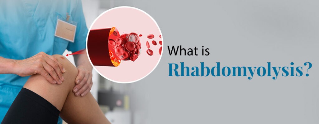 What is Rhabdomyolysis?