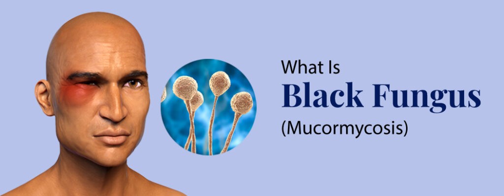 What is Black Fungus (Mucormycosis)?