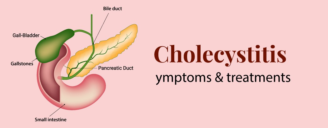 Cholecystitis: Symptoms and Treatment
