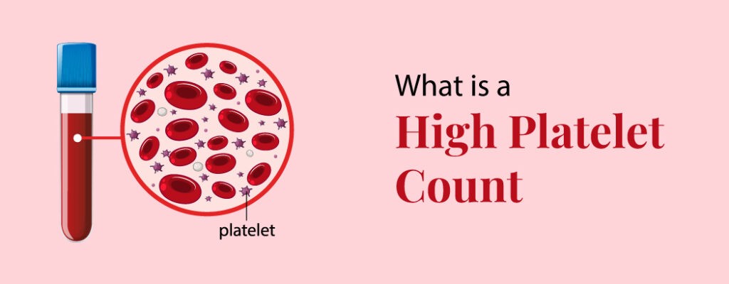 What is a high platelet count?
