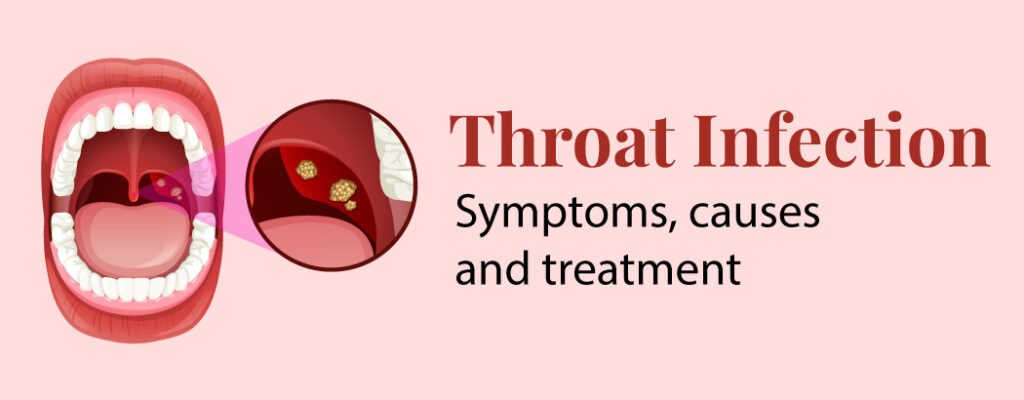Throat Infection: Symptoms, Causes and Treatment