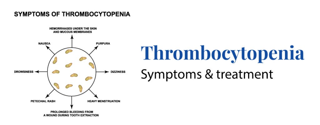 Thrombocytopenia: Symptoms and Treatment